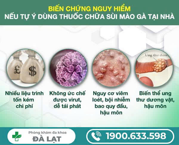 Hình ảnh minh họa