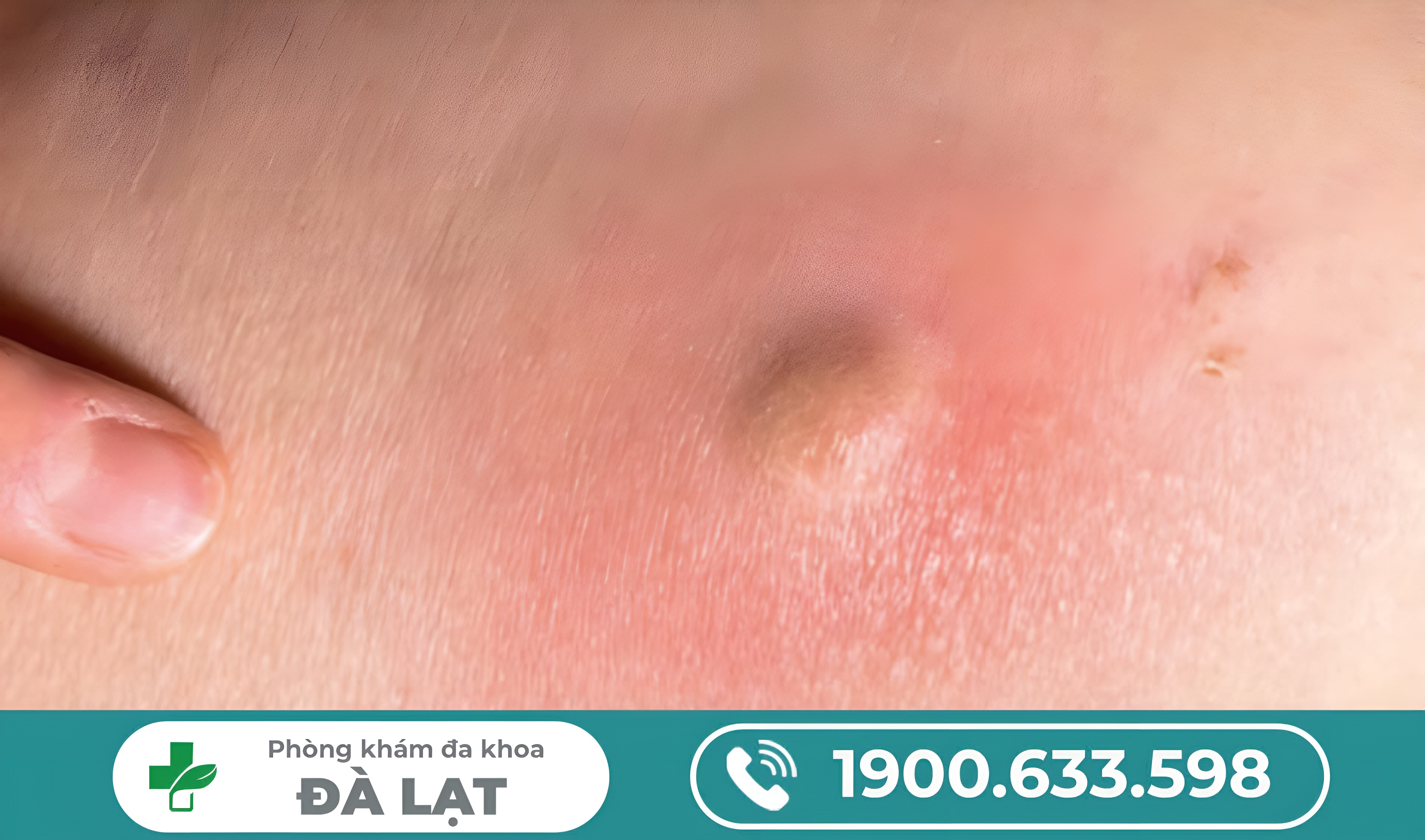 Hình ảnh minh họa