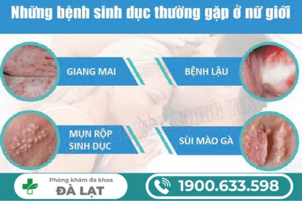 Hình ảnh minh họa