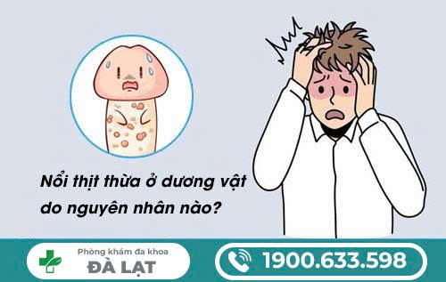 Hình ảnh minh họa