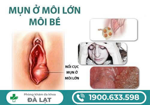 Hình ảnh minh họa