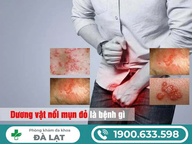 Hình ảnh minh họa