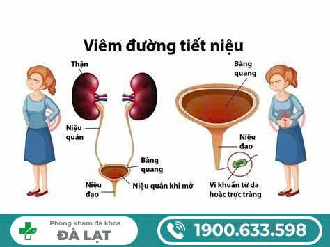 Hình ảnh minh họa