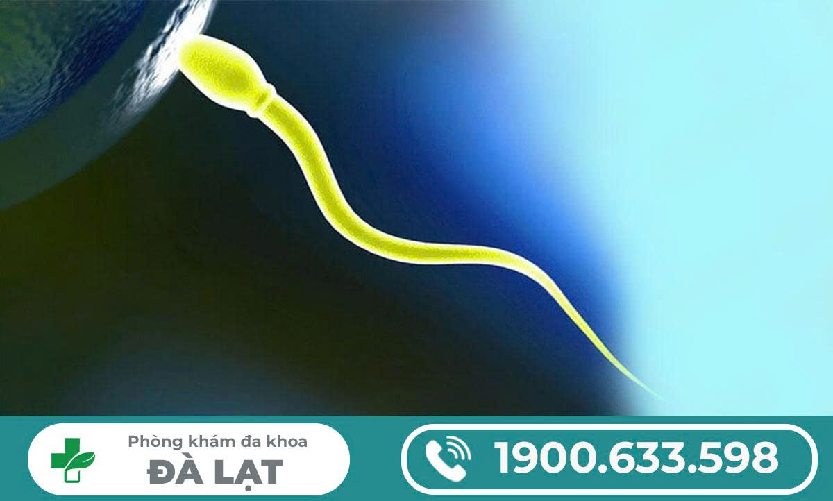 Hình ảnh minh họa