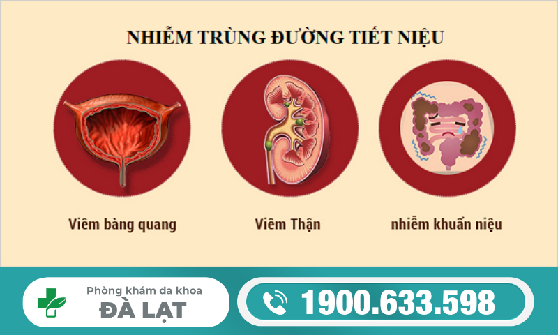 Hình ảnh minh họa