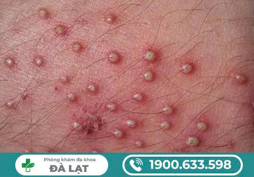 Hình ảnh minh họa