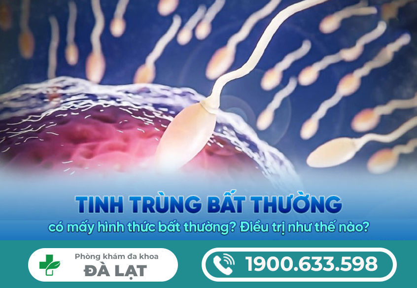 Hình ảnh minh họa